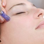 Microneedling – die Beauty-Behandlung gegen Dehnungsstreifen und Narben