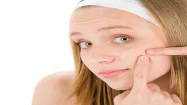 Akne Wirkstoffe – Die kleinen Helfer gegen Akne, was bringen sie wirklich?
