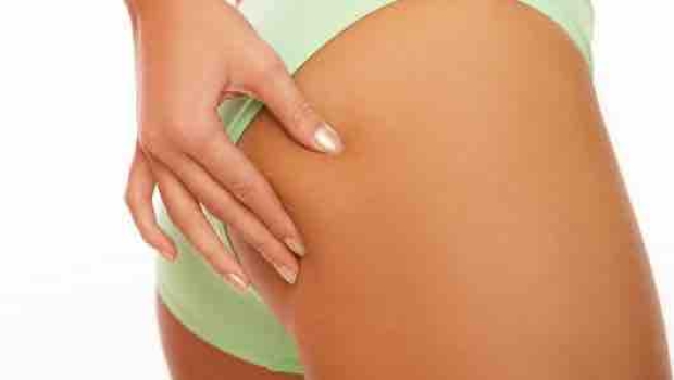 Cellulite Horror – Den Ursachen auf der Spur
