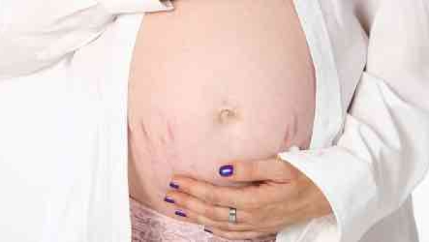 Schön Schwanger – was tun gegen Schwangerschaftsstreifen?